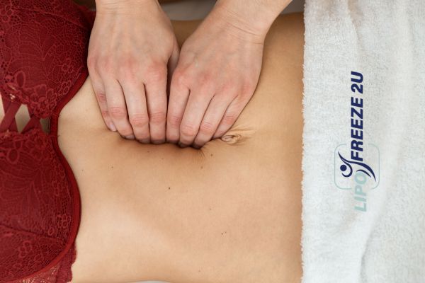 diastasis recti treatment Northwich
