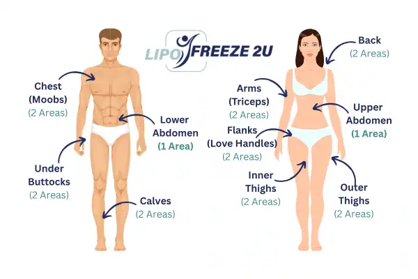Areas you can have fat freezing treatment Northwich