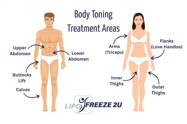 Graphic showing where you can have Body toning Treatment Northwich on your body
