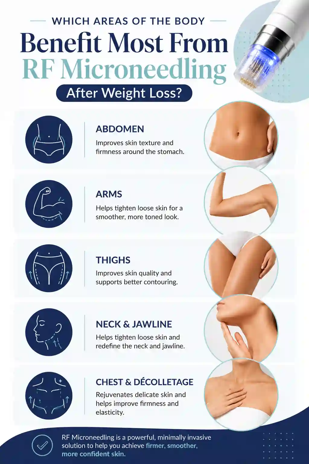 Which Areas of the Body Benefit Most From RF Microneedling After Weight Loss Northwich